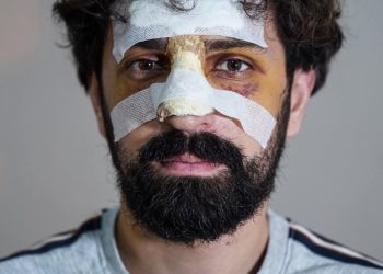 “მინდა, ცოტა ხანი უყუროთ ამ ფოტოს და ასე მხედავდეთ” – ალექსანდრე ქეშელაშვილი