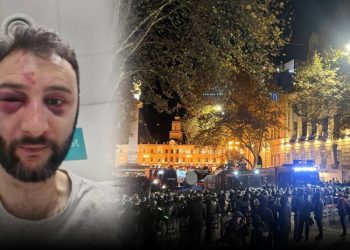 სპეცრაზმელების მიერ ნაცემ აქციის მონაწილეს თვალისა და ყბის ოპერაცია ჩაუტარდა