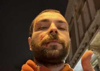 გელა ხასაიას თავს დაესხნენ და ფიზიკურად გაუსწორდნენ