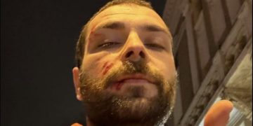 გელა ხასაიას თავს დაესხნენ და ფიზიკურად გაუსწორდნენ