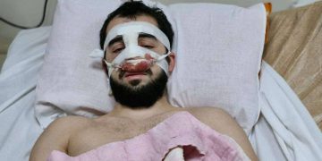 პოლიციელებმა აქციაზე სასტიკად ნაცემ ახალგაზრდას ნახმარი წინდა მისცეს სისხლის შესაჩერებლად – უფლებები საქართველო