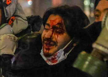 რეანიმაციაშია, უგრძელდება მედიკამენტური ძილი, სასიცოცხლო პარამეტრები სტაბილურია – ექიმი აქციაზე დაშავებულ 22 წლის ახალგაზრდაზე