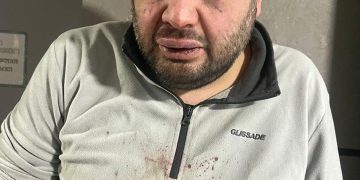 ,,საშინლად გაუსწორდნენ ექიმს, რომელიც გაზით მოწამლულებს ეხმარებოდა”