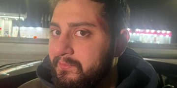 ,,გამოუშვეს ნაცემი” – ცოტნე კობერიძე გამოუშვეს