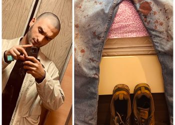 კორდონის გავლით შემტენეს მიკროავტობუსში, სადაც გარედან მირტყამდნენ ხელებს, ფეხებს, რამდენჯერმე მომხვდა ხელკეტიც. დასისხლიანებულს გადამიღეს ფოტო, გააგზავნეს რაღაც ჩატში და ჩაიწერეს ჩემი მონაცემები – გიორგი დარბაიძე