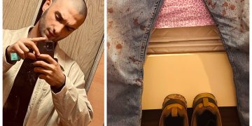 კორდონის გავლით შემტენეს მიკროავტობუსში, სადაც გარედან მირტყამდნენ ხელებს, ფეხებს, რამდენჯერმე მომხვდა ხელკეტიც. დასისხლიანებულს გადამიღეს ფოტო, გააგზავნეს რაღაც ჩატში და ჩაიწერეს ჩემი მონაცემები – გიორგი დარბაიძე