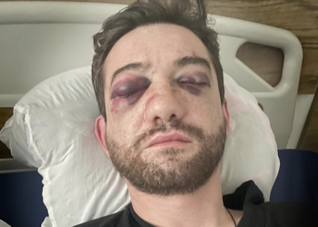 დაკავების შემდეგ, საბა ქევხიშვილს მიკროავტობუსში რამდენიმე სპეცრაზმელი უწყვეტად, მონაცვლეობით ურტყამდა – სოციალური სამართლიანობის ცენტრი