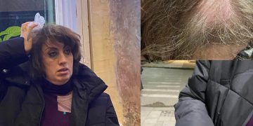 ფოთში, ჟურნალისტ ელისო ჯანაშიას თავს დაესხნენ