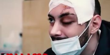 რას ყვება სიკვდილს სასწაულით გადარჩენილი 21 წლის ალექსი თირქია