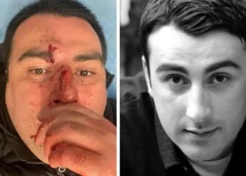 ბესო ზანგურს სცემეს – რას წერს მსახიობი?