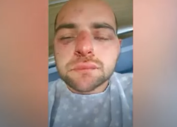 +18 – “მოდი, ხელი მოვტეხოთო” – გატაცების, წამების კიდევ ერთი სასტიკი ისტორია