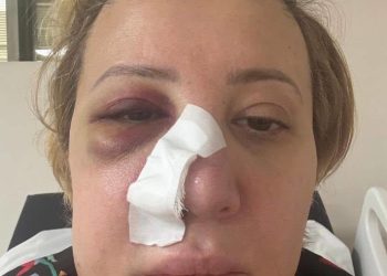 “ნინო კვიტაიშვილს “ტიტუშკის” ნასროლი, შუშის ბოთლი მოხვდა სახეში” – ნიკა მელია