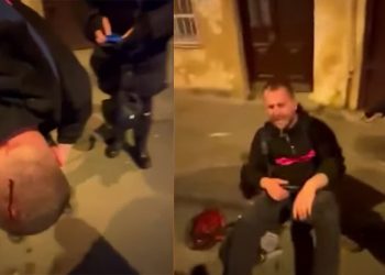 “შაბათის ეთერის” ოპერატორს მძიმე დაზიანება თავის არეში აღენიშნება – გიორგი შეწირული და მაკა ჩიხლაძე კლინიკაში გადაჰყავთ