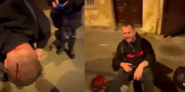 “შაბათის ეთერის” ოპერატორს მძიმე დაზიანება თავის არეში აღენიშნება – გიორგი შეწირული და მაკა ჩიხლაძე კლინიკაში გადაჰყავთ