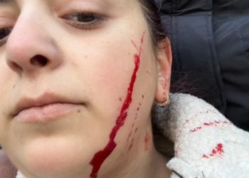 “გაა@ვი ევროპაში” – სკოლის თანამშრომელი დაჭრეს