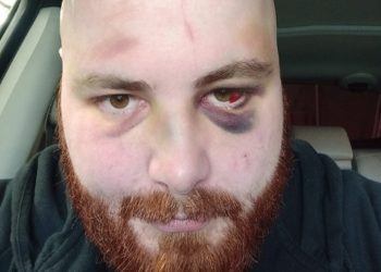 “ოთხოვდნენ, გვეთქვა ხარება მაგარი კაცია” – სასტიკად ნაცემი მოქალაქის ისტორია