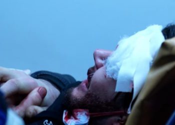 როგორია აქციაზე დაშავებული 22 წლის ბიჭის ჯანმრთელობის მდგომარეობა – ბიძის კომენტარი