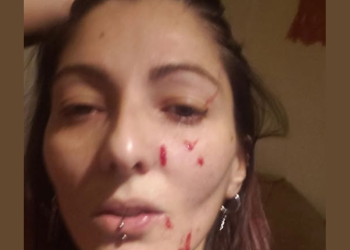 “@ლე ვერ მომჭამოთ ნაბო@რებო!” – აქტივისტს თავს დაესხნენ