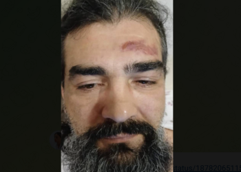 გუშინ დაკავებული გია ჯვარშეიშვილი კლინიკაში რჩება – უფლებადამცველს სისხლჩაქცევები აღენიშნება