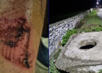 “თავსახური საერთოდ არ ჰქონდა ამ ლუქს, რაღაც სასწაულად გადავრჩი, კი იქნებოდა სიღრმით ასე 3 მეტრამდე” – რას წერს ზურაბ ფარჯიანი