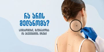 რა არის მელანომა? – სიმპტომები, მკურნალობა და პრევენციის გზები
