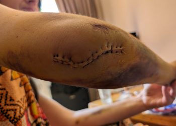 “მადლობა ხარებას… ეს ჩემი დალურჯებების არასრული სიაა” – მარიამ დოლიძე