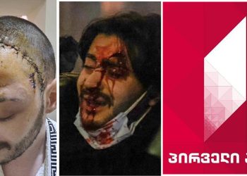 “არ მსურდა ამ ფოტოების გამოქვეყნება, მაგრამ იძულებული გავხდი!” – ალექსი თირქია