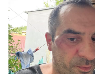 რას ამბობს ვანიკო თარხნიშვილი თავდასხმაზე?