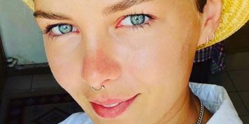 ,, შეიძლება უბრალოდ მოვკვდე თუ დროზე არ მივალ…” – მარტა ბარამიძეს დახმარება ესაჭიროება