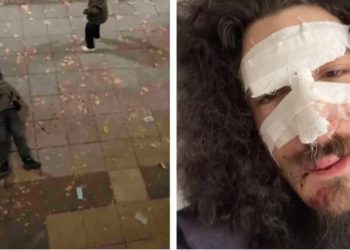 აქციაზე სპეცრაზმის მიერ ნაცემი ზვიად მაისაშვილი 8 თვის შემდეგ დაზარალებულად ცნეს