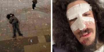 აქციაზე სპეცრაზმის მიერ ნაცემი ზვიად მაისაშვილი 8 თვის შემდეგ დაზარალებულად ცნეს