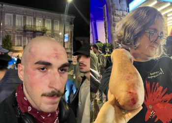 დაშავებულთა ზუსტი რაოდენობა უცნობია