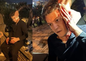 ნარმანიამ ისიც ვერ მოახერხა,რომ თავში არ მოხვედროდა, იმიტომ რომ ნაცია – კობახიძე