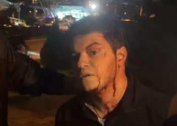 შსს: გამოკითხულია ინციდენტში მონაწილე 3-ვე მხარე, მიმდინარეობს საგამოძიებო მოქმედებები