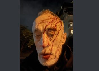 “3 ტიპი დამხვდა სახლთან” – ნადიმ ხმალაძე სცემეს