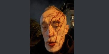 “3 ტიპი დამხვდა სახლთან” – ნადიმ ხმალაძე სცემეს