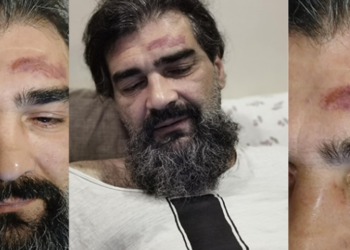 ცემა, გაქურდვა და 72 ჯარიმა – გია ჯვარშეიშვილის ისტორია