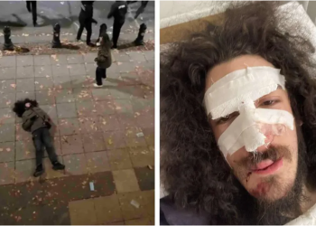 “ვყვიროდი, რომ არ დაერტყათ, მაგრამ მაინც მირტყამდნენ. გავიდა უკვე ერთი წელი და რიგითი რობოკოპიც კი არ არის დაკითხული” – ზვიად მაისაშვილი