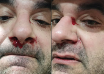 “პუტინმა დაა@ვა თქვენს ტიტუშკებს”– რომან აკოპოვს სახლთან დახვდნენ