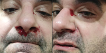 “პუტინმა დაა@ვა თქვენს ტიტუშკებს”– რომან აკოპოვს სახლთან დახვდნენ