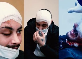 1 წელი ალექსანდრე თირქიას უმძიმესი დაზიანებიდან და არც ერთი დაკავებული