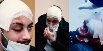 1 წელი ალექსანდრე თირქიას უმძიმესი დაზიანებიდან და არც ერთი დაკავებული