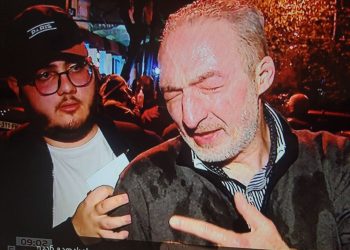 “თირკმელზე დამიდგინდა სიმსივნური კვანძი” – მიშიკო რამიშვილი აქციებზე წყლის ჭავლით და გაზით დაზიანებებზე საუბრობს