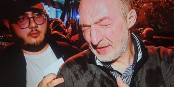 “თირკმელზე დამიდგინდა სიმსივნური კვანძი” – მიშიკო რამიშვილი აქციებზე წყლის ჭავლით და გაზით დაზიანებებზე საუბრობს