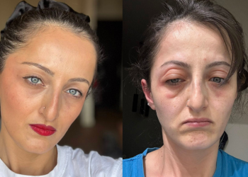 “რითი მომწამლეს? – გამომწვევ მიზეზებში წერია ქიმიური ნივთიერებით დაბინძურებული წყალი” – სალი ბაკურაძე