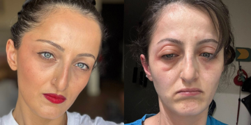 “რითი მომწამლეს? – გამომწვევ მიზეზებში წერია ქიმიური ნივთიერებით დაბინძურებული წყალი” – სალი ბაკურაძე