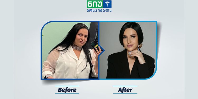 2 Circle connected 3D infographic. Two labels. Vector template.