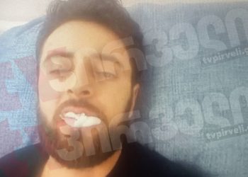 ბოლნისში, აქტივისტს თავს დაესხნენ – კაცი ჯგუფურ ანგარიშსწორებაში “ოცნების” მხარდამჭერებს ადანაშაულებს