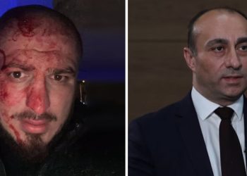 უბილავა ცემას უარჰყოფს და შსს ცემის ფაქტს იძიებს – დეტალები