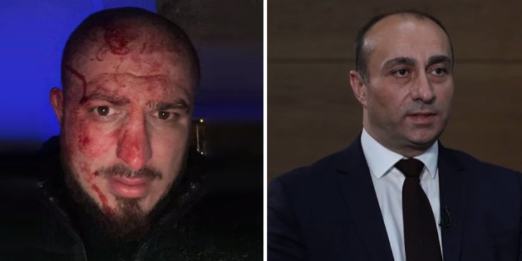 უბილავა ცემას უარჰყოფს და შსს ცემის ფაქტს იძიებს – დეტალები